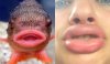 kylie_jenners_lip_challenge_is_giving_girls_fish_lips_640_12.jpg